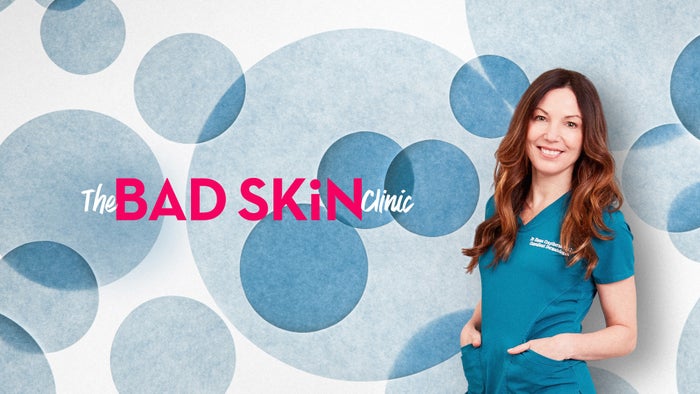 The Bad Skin Clinic Episode No.2 on JioTV