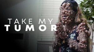 Take My Tumor on Discovery Science Hindi - past program