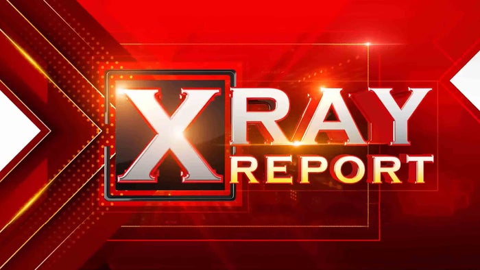 X Ray Report on JioTV