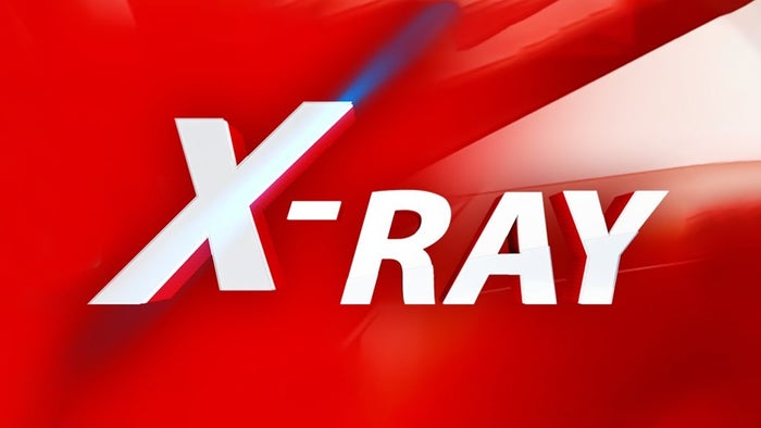 X Ray on JioTV