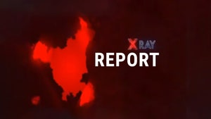 X-Ray Report on NDTV India