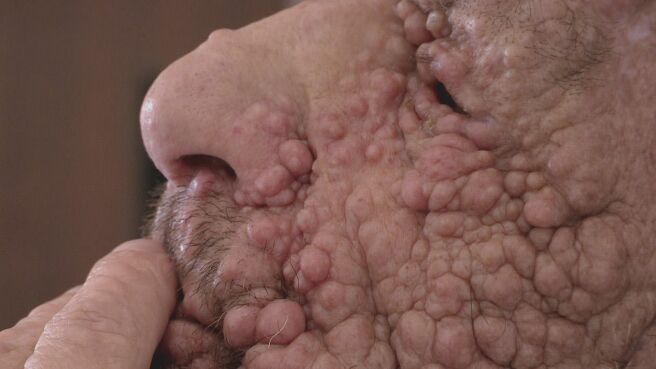 Body Bizarre season 2 episode 9 on Discovery Plus