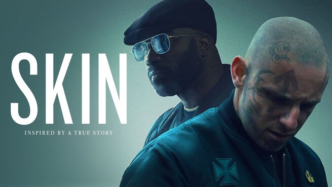 Skin on LionsGate