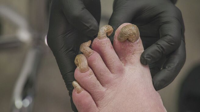 My Feet Are Killing Me season 1 episode 16 on DiscoveryPlus