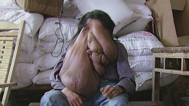 Body Bizarre season 2 episode 7 on Discovery Plus